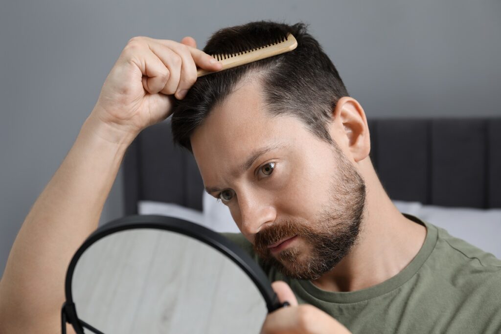Hombre revisando pérdida de cabello antes de implante capilar en Jerez