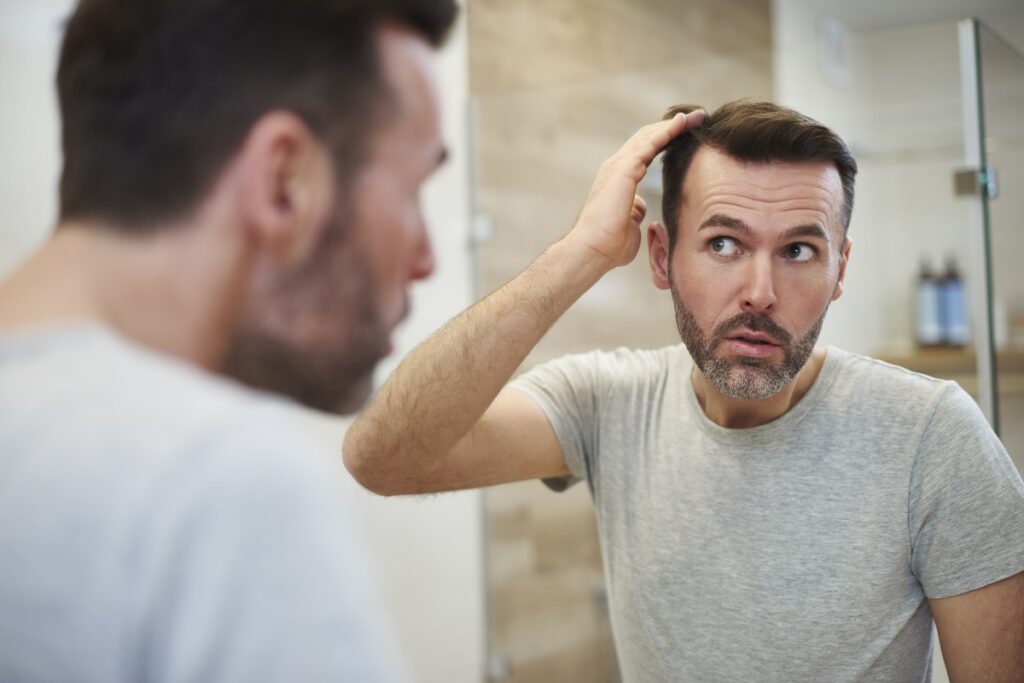 hombre observando pérdida de cabello en el espejo antes de injerto capilar en Jerez