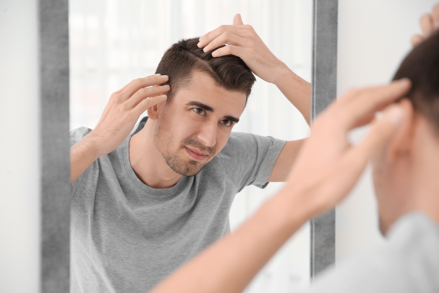 hombre observando caída del cabello en el espejo antes de injerto capilar en Jerez