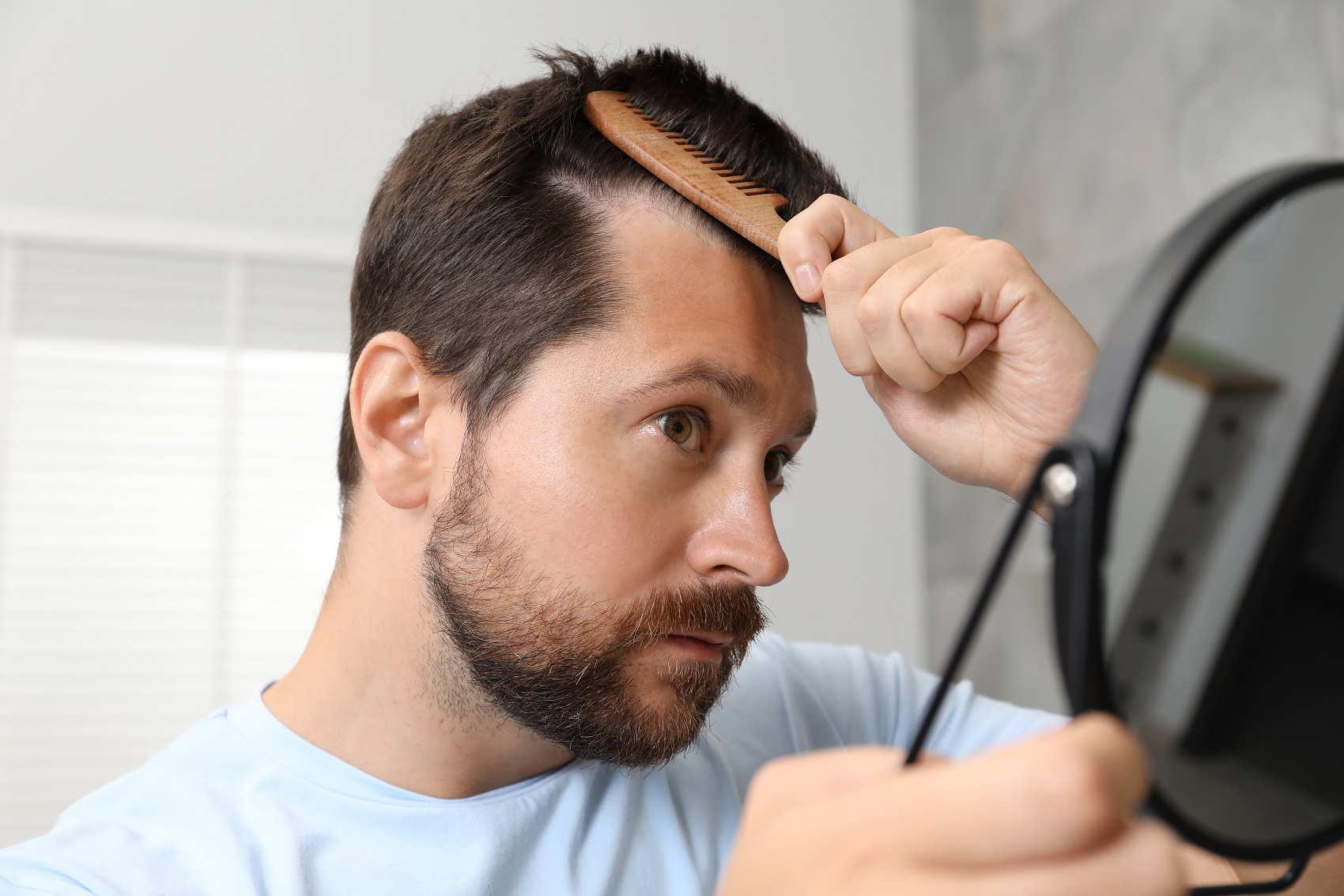 hombre peinándose frente al espejo con signos de caída de cabello en Jerez